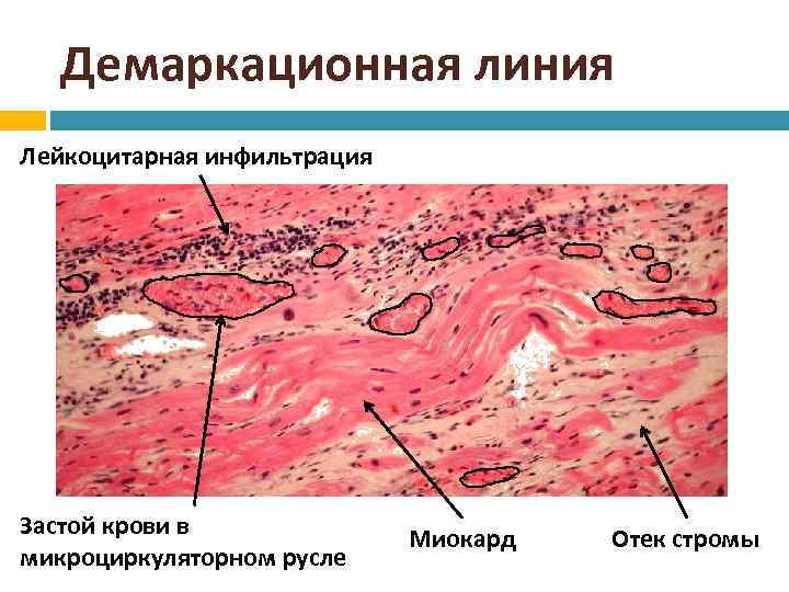 Демаркационная линия