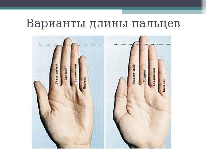 Болезнь нотта или стенозирующий лигаментит пальца: причины и лечение