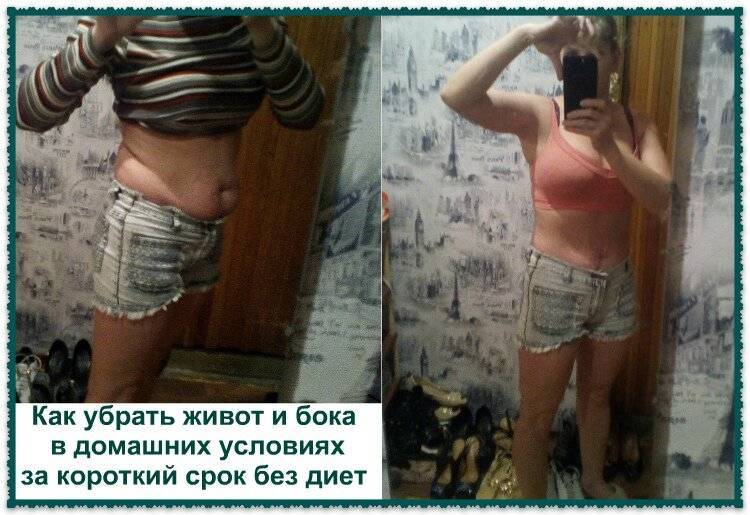 Почему убрать жир локально, можно только при помощи операции  | igor-butko.ru
