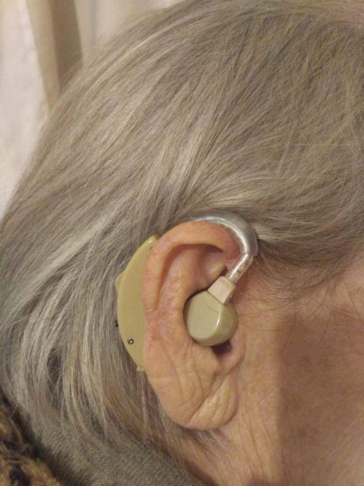 Слуховые аппараты для пожилых людей. особенности покупки слухового аппарата пожилому человеку