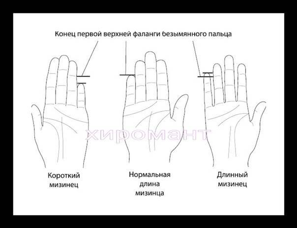 Молоткообразная деформация пальцев