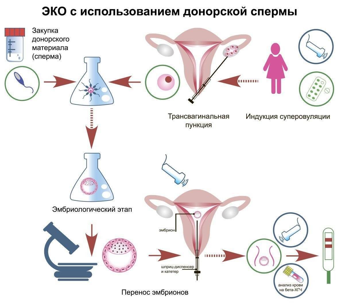 как сделать эко с донорской спермой (120) фото