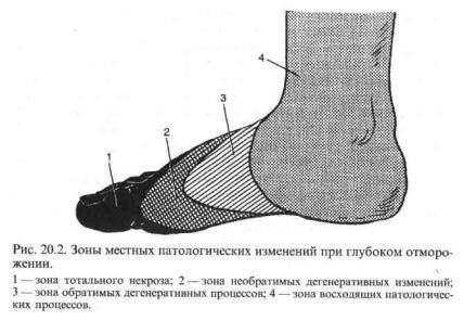 Военная демаркационная линия - frwiki.wiki